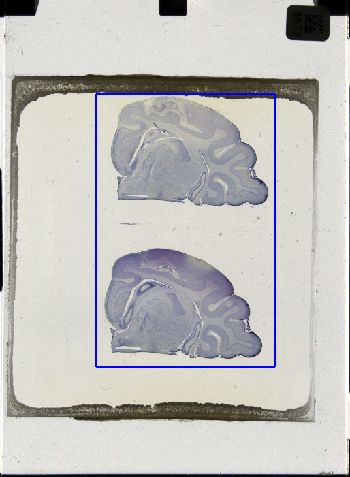 Media type: image; Special Collections 3043   shows specimen_part histological serial section;